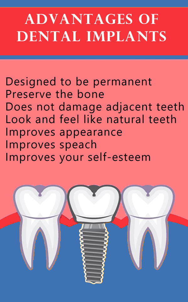 Advantages-of-Dental-Implants-1.jpg